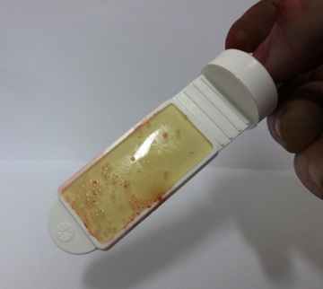 Bacteria appears as red dots